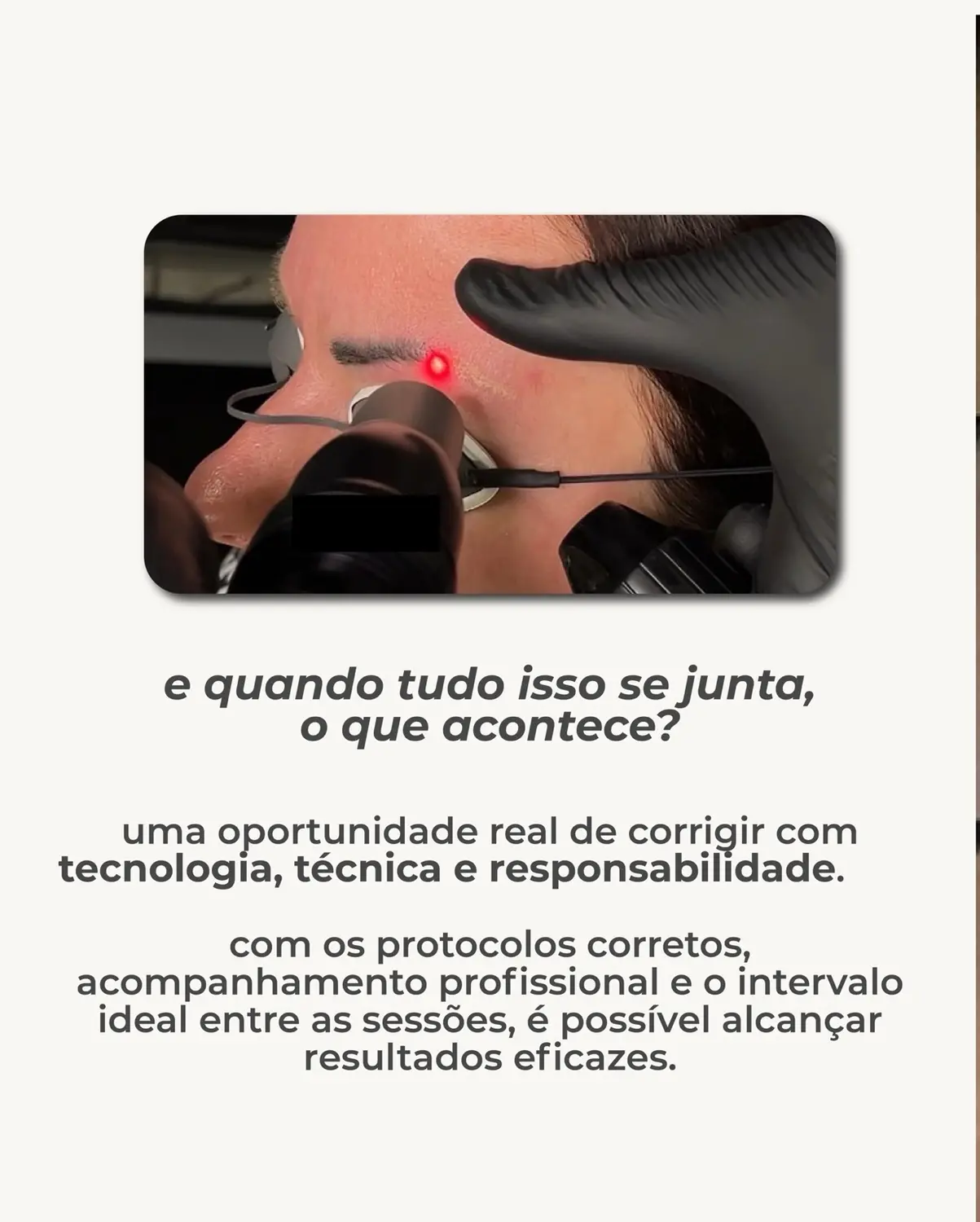 Aplicação profissional de laser para remoção de pigmento nas sobrancelhas