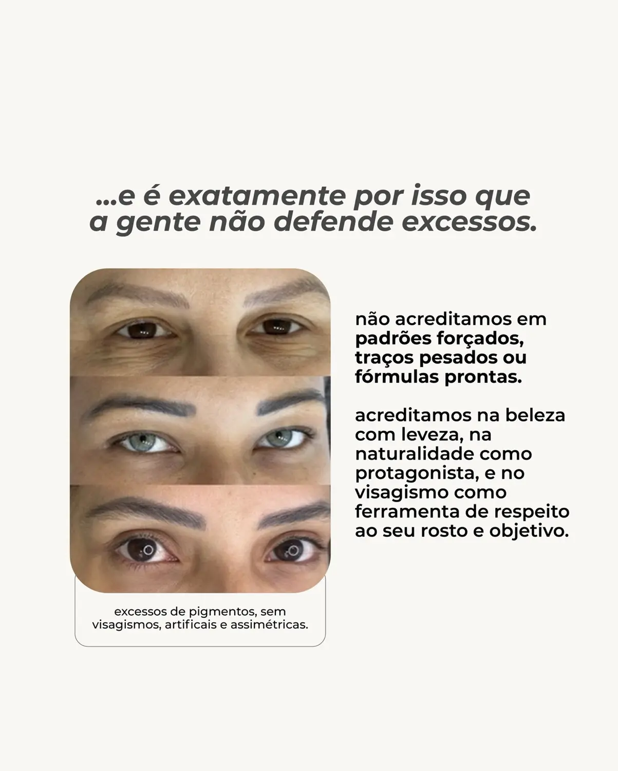Exemplo de micropigmentação com excesso de pigmento e formato marcado